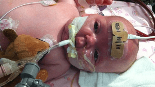 Kentucky Records Third Unvaccinated Infant Death as Pertussis Surge Continues