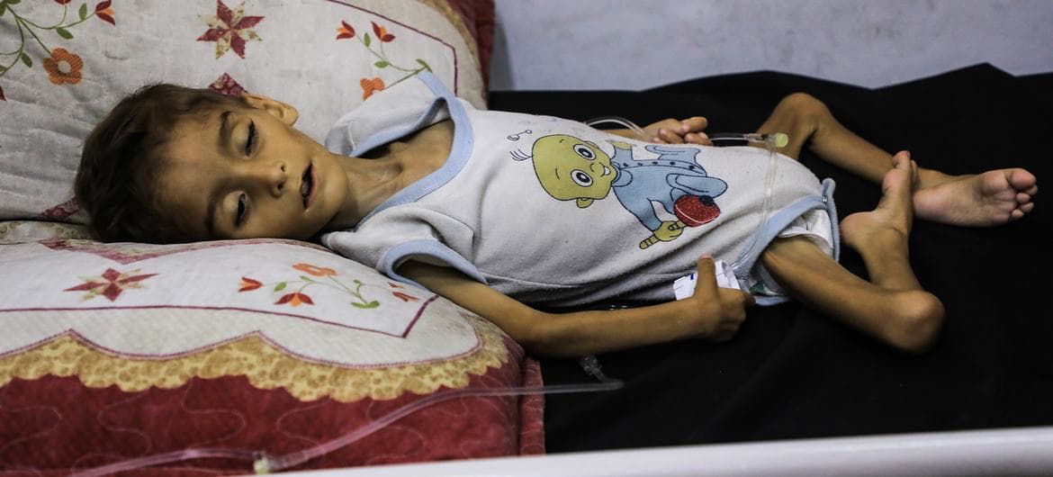 Thousands of Gaza Children Still Acutely Malnourished After Truce