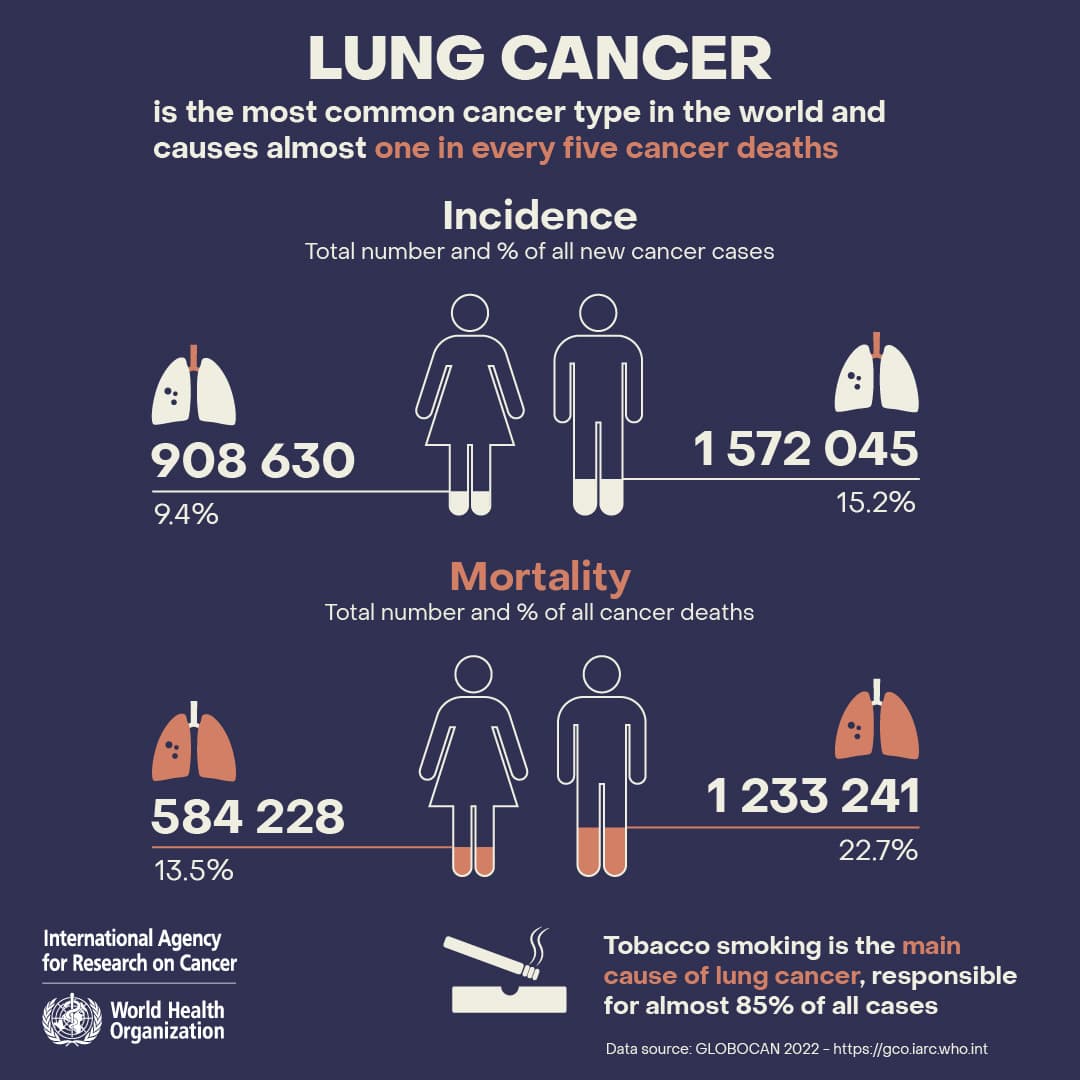 Lung Cancer Awareness Month highlights disproportionate toll on Black women